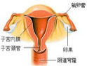 宫颈疾病简介